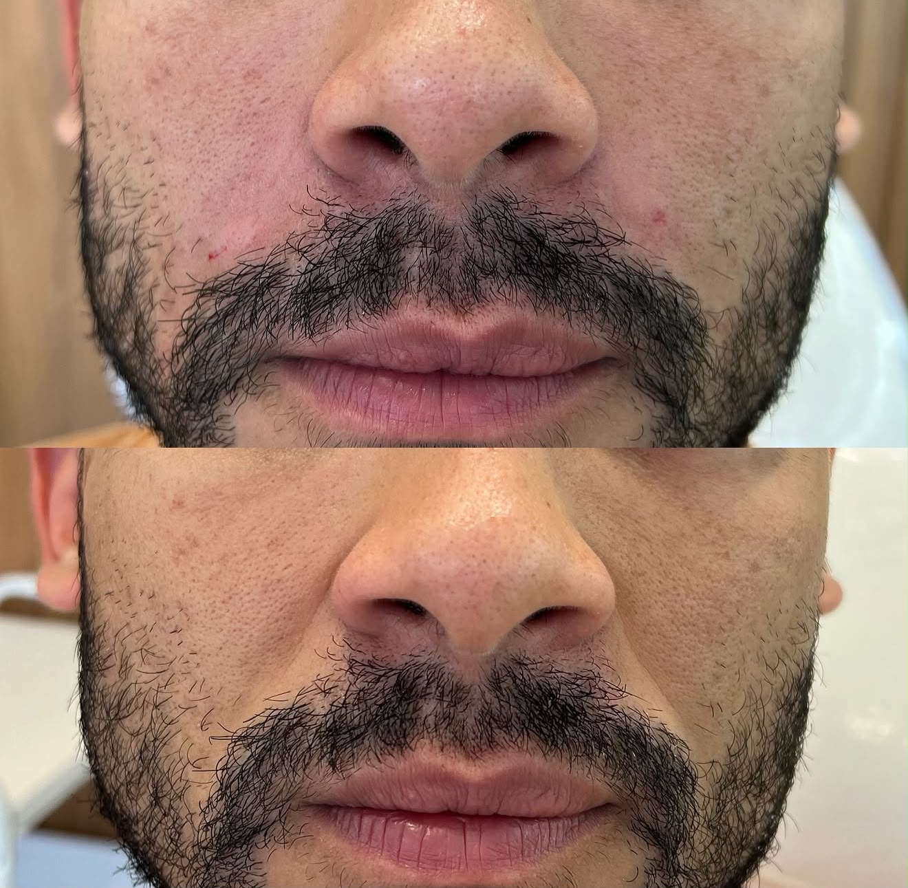 Preenchimento de Bigode Chinês — foto 1