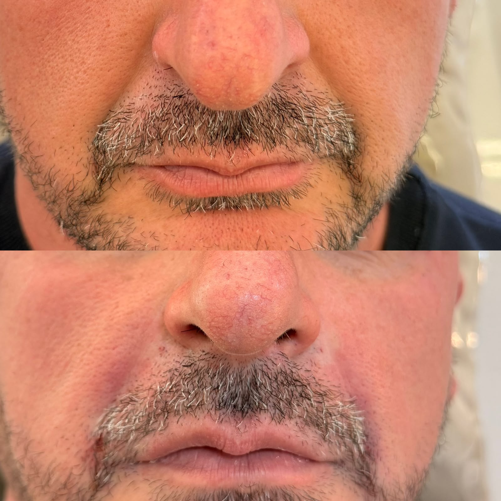 Preenchimento de Bigode Chinês — foto 4