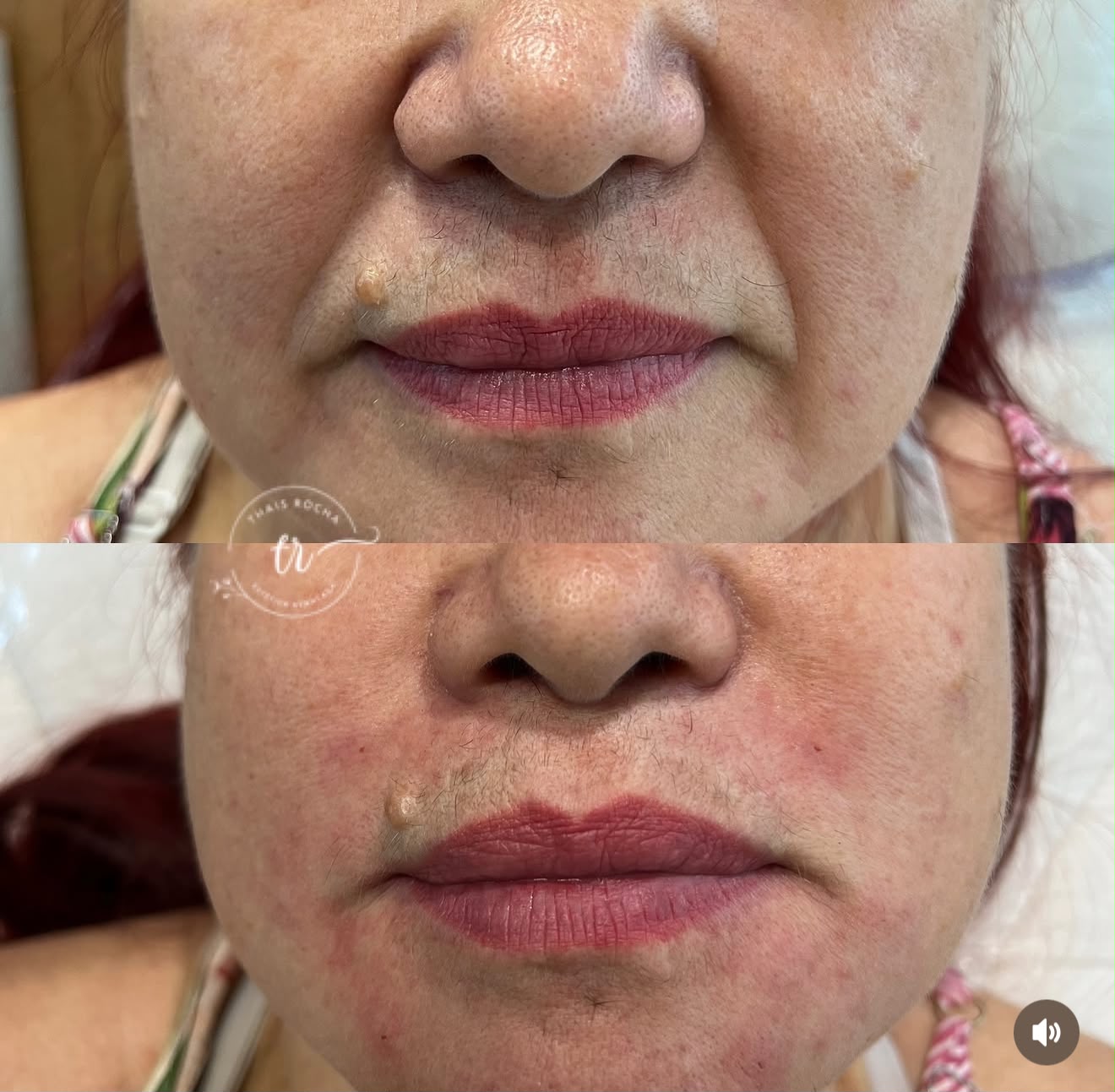 Preenchimento de Bigode Chinês — foto 5
